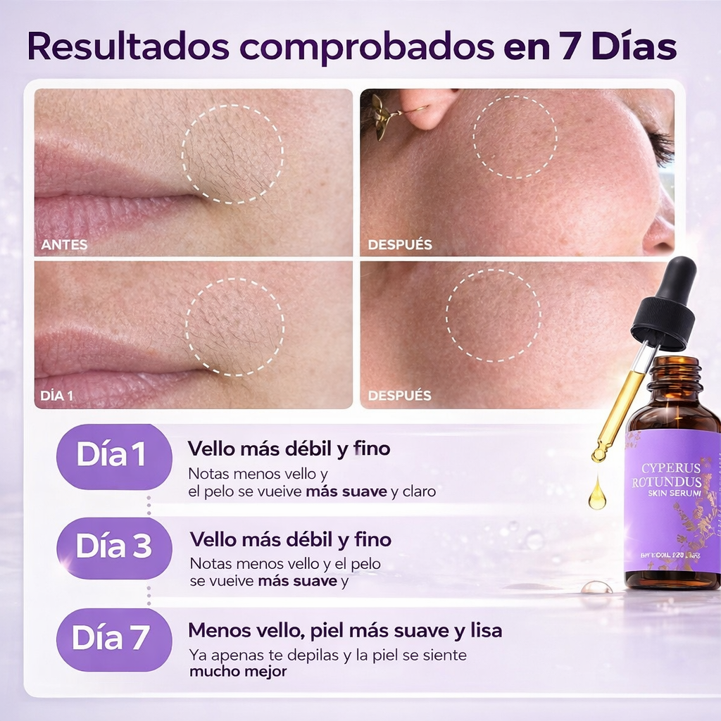 Aceite Cyperus Rotundus