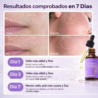 Aceite Cyperus Rotundus